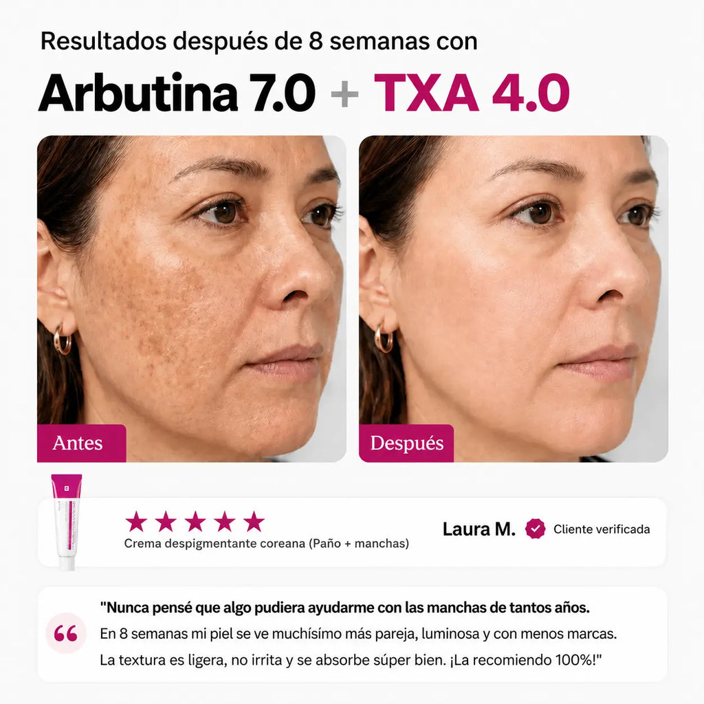 ElevenBerry™ Arbutina 7% + TXA 4%