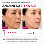 Crema despigmentante arbutina